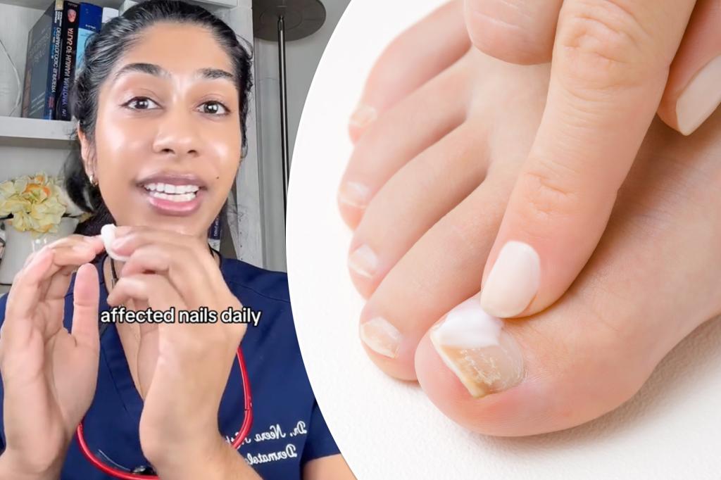 An inexpensive oral health remedy can treat toenail fungus